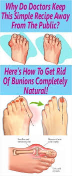 Pin On Best Knee Pain Tips