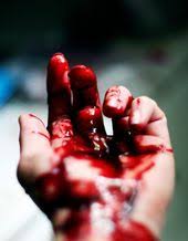 We did not find results for: Blood Aesthetic