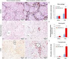 Immunohistochemistry For Macrophages F4 80 A And B For Neutrophils Download Scientific Diagram