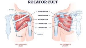 Image result for Rotator Cuff Rupture