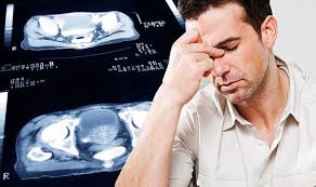 In fact, men who develop prostate cancer may never exhibit signs and symptoms of prostate cancer, even during advanced stages. Prostate Cancer Symptoms Signs The Disease Has Advanced And You Need Help Fast Express Co Uk