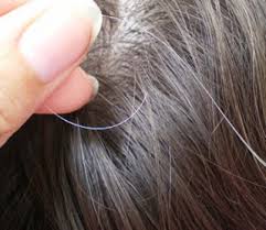 The regular discharge can make your body highly fragile and weak so the proper treatment is necessary. White Hair Treatment In Homeopathy Archives Welcome To Ind Lives News Latest News Hindi Breaking News In Hindi Live Hindi News Headlines Top News India Current Hindi News World Entertainment News