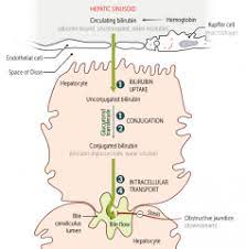 First Aid Gastrointestinal Pathology Flashcards Cram Com