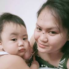 GET WELL SOON, ARTHUR AND BERNARDO! IN PHOTOS: Conjoined twins born in  Brazil with a fused head and brain have been separated in what doctors  described Monday as the most complex surgery