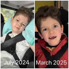 Rafi has amazed us this week, particularly in the area of speech and  cognition. A couple of weeks ago he began initiating speech by saying  'chair' and 'walk' (which we documented on