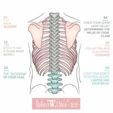 If a patient is taken to the hospital by ambulance and was complaining of back pain following the accident. What To Do About Back Pain After A Car Accident In Daytona Beach