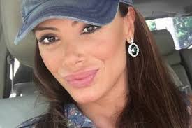 Roxana Muñoz muestra cómo quedaron sus labios tras cirugía reconstructiva —  Pudahuel