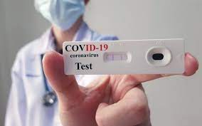 Koronavirová infekce se prokazuje buď přímo pomocí molekulární biologické metody pcr, anebo se imunoanalýzou prokazují protilátky na covid. Testovani Na Onemocneni Covid 19