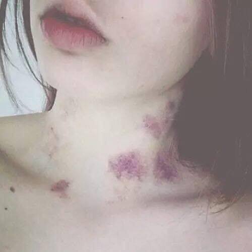 images