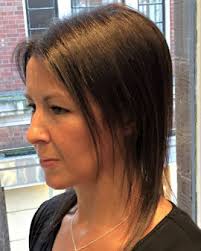 In women, this condition seems to be more frequent in those in rare cases, women may experience female pattern baldness. Female Pattern Hair Loss Androgenetic Alopecia Lucinda Ellery Inc La And Nyc