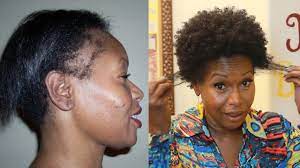 Mielle organics simply does not miss with its hair products, and the rosemary mint strengthening edge gel is no exception. 7 Ways To Grow Your Edges Back And Treat A Thinning Hairline Naturallycurly Com