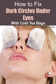 How To Use Tea Bags For Dark Circles Under Eyes If You Want To Revamp That Your Beautiful Or Handsome Face Back W In 2020 Dark Circles Under Eyes Undereye Dark Circles