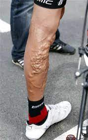 Chris froome was born on may 20, 1985 in nairobi, kenya as christopher clive froome. Radfahrer Zeigen Was Bei Der Tour De France An Ihren Beinen Ansetzen Kann