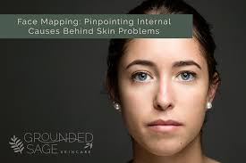 Skin Mapping Chart Pinpoint Internal Causes Of Problem