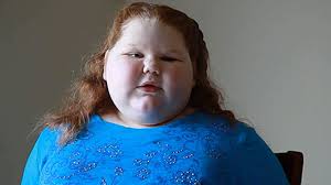 12-Year-Old Alexis Shapiro Has Complications During Weight-L