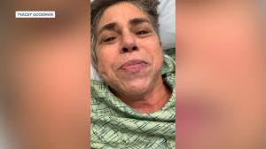 Forest ranger shoots off knee cap in accident