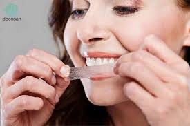 Miếng dán tẩy trắng răng: Những điều cần lưu ý trước khi sử dụng