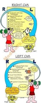 right cva vs left cva nurse practitioner nursing