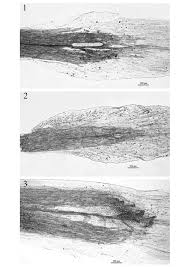 Image result for Pseudognaphalium oligandrum