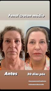 Dr Marco Antonio (@dr_marcoantonio) • Instagram photos and videos