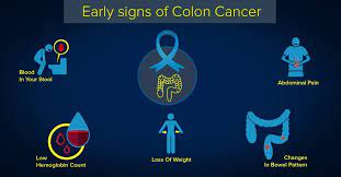Get the latest colon cancer help and advice from mayo clinic delivered in your inbox. 5 Early Signs That Shout Colon Cancer Advanced Cancer Treatment Centers