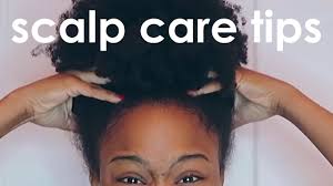 Try my simple & effective diy treatments How To Get Rid Of Dry And Itchy Scalp For Natural Hair 5 Healthy Scalp Care Tips Youtube