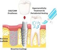 Glass-ceramics in dentistry: Fundamentals, technologies ...