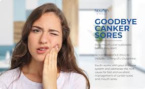 Amazon.com: Exulin is Fast & Effective Treatment for Canker Sores. Targets  Mouth Sores & Mouth Ulcers, Providing Optimal Relief. Packed with Potent ...