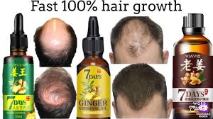 23 likes · 424 talking about this. 7 Days Viavic Ginger Hair Oil Vs Germinal Ginger Hair Regrow Serum Youtube