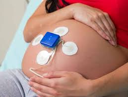 Image result for Structured Intermittent Auscultation