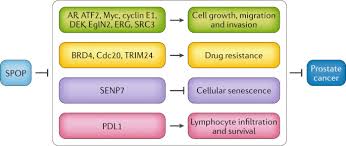 However, an overview about the role of zinc and its signaling in pca is needed. The Diverse Roles Of Spop In Prostate Cancer And Kidney Cancer Nature Reviews Urology