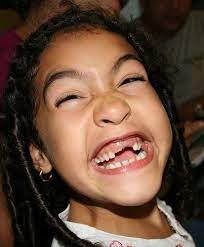 Only A True Friend Will Forgive You When You Knock Out Her Two Front Teeth True Story True Friends Funny Faces Wtf Face