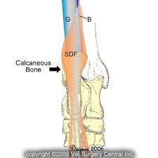 Lower thigh is the one found beneath the knee and goes all the way to the hock. Animal Surgical Center Of Michigan Veterinarian In Flint Mi