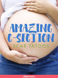 See more ideas about body art tattoos, tattoos, scar tattoo. 12 Breathtaking C Section Scar Tattoos Sheknows