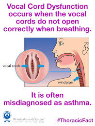 Image result for Vocal Cord Dysfunction