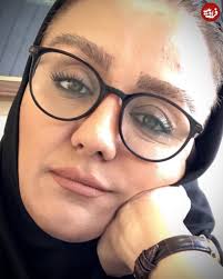 فرارو | چهره نسرین مرادی بازیگر سریال «نون خ» بعد از ۵ سال (تصاویر)