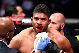 See more of alistair overeem on facebook. Alistair Overeem S Lip Explodes In Shocking Ufc Knockout