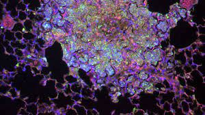 Francisella tularensis is carried by many species of wild rodents, rabbits, beavers. Francisella Tularensis College Of Sciences