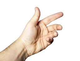 Symptom Of Dupuytren S Contracture