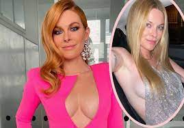 RHONY's Leah McSweeney Shares Uncensored Photo Showing Breast Lift Scar -  Perez Hilton