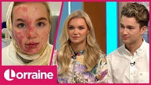 Abbie Burns's Instagram, Twitter & Facebook