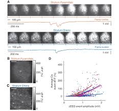 Can't find a movie or tv show? Calcium Imaging Of Ca1 A Successive Movie Frames And Simultaneous Download Scientific Diagram