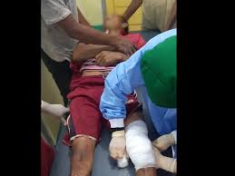 Wasichana wa shule uchi : Tabrakan Dua Sepeda Motor Di Manggarai Timur Satu Tewas