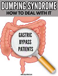 Pin On Bariatric Surgery