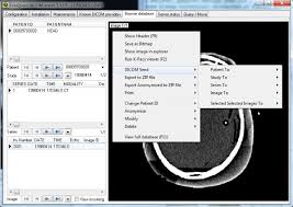 Microdicom is a free dicom viewer. Conquest Dicom Software