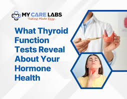 Image result for Thyroid Function Test