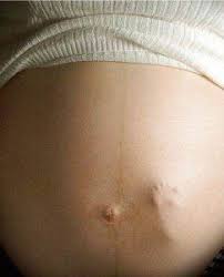 Una Estrella Viene En Camino Pies De Bebe Fotos Fotos De Embarazadas