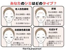 顔のシミを消す方法 自力で消したい人におすすめのケア法と食べ物 顔のシミ スキンケア用品 カオナシ