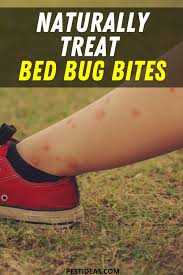 naturally treat bed bug bites bed bug bites bed bug bites remedies bed bug bites treatment