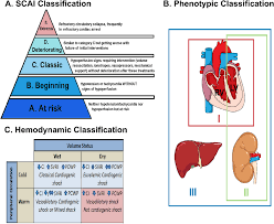 Management of cardiogenic shock: a narrative review | Annals of Intensive  Care | Springer Nature Link